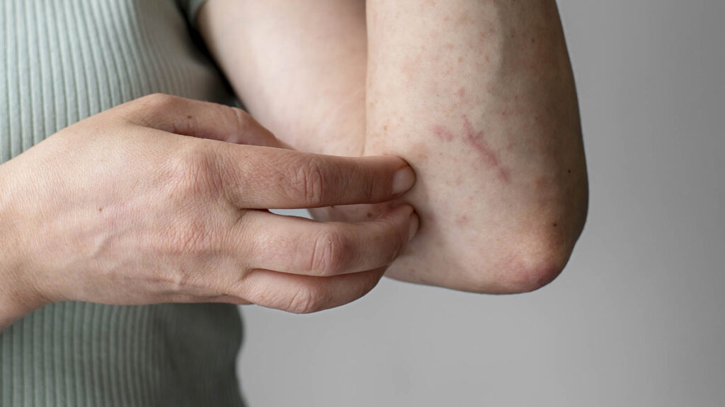 Dermatiti e Infiammazioni della Pelle